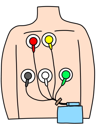 ホルター心電図