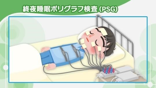 終夜睡眠ポリグラフ検査（PSG検査）